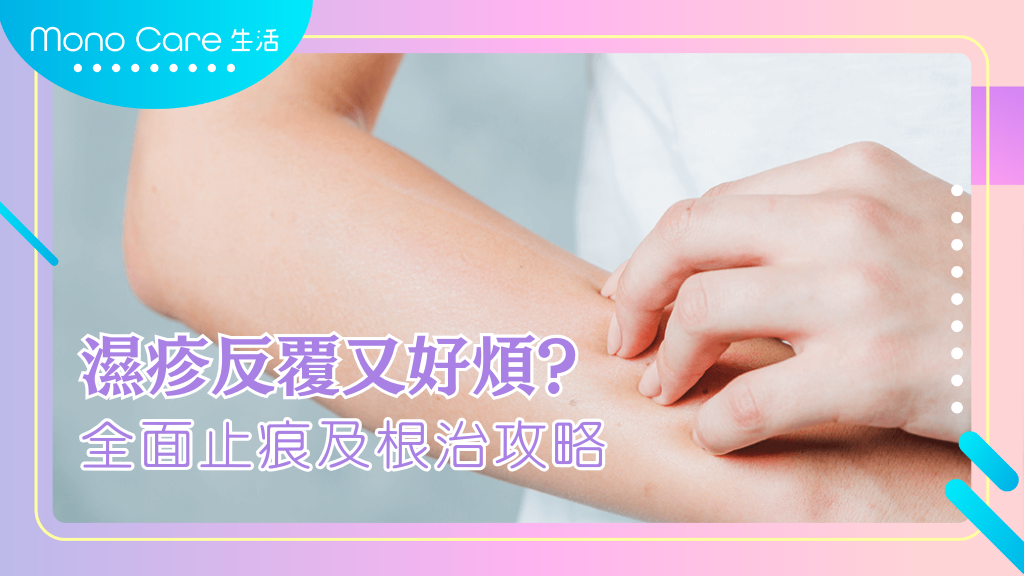 濕疹反反覆覆好煩？全面攻略止癢同根治方法！