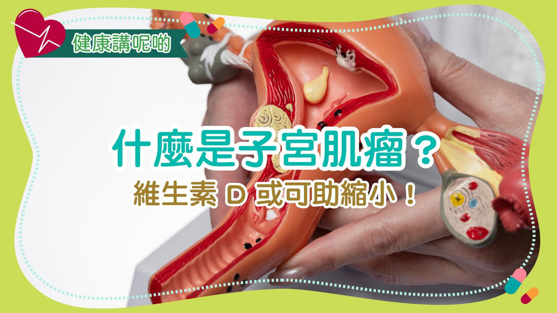 甚麼是子宮肌瘤？維生素 D 或可助縮小！