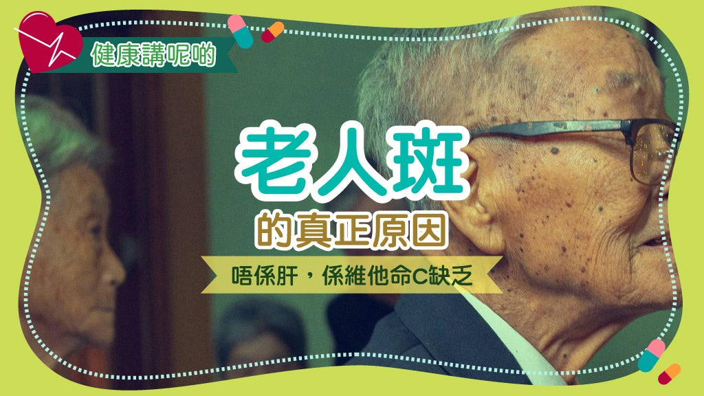 老人斑的真正原因：唔係肝，係維他命C缺乏！